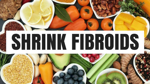 5 FOODS THAT HELP SHRINK UTERINE FIBROIDS