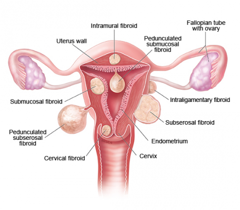 How to Get Your Ceased Period Back in 2 Easy Steps