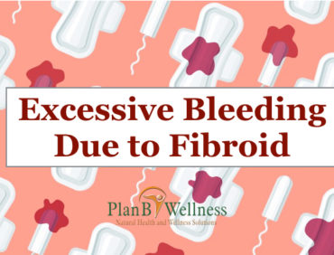 EXCESSIVE BLEEDING DUE TO FIBROID STOPPED WITHIN ONE WEEK