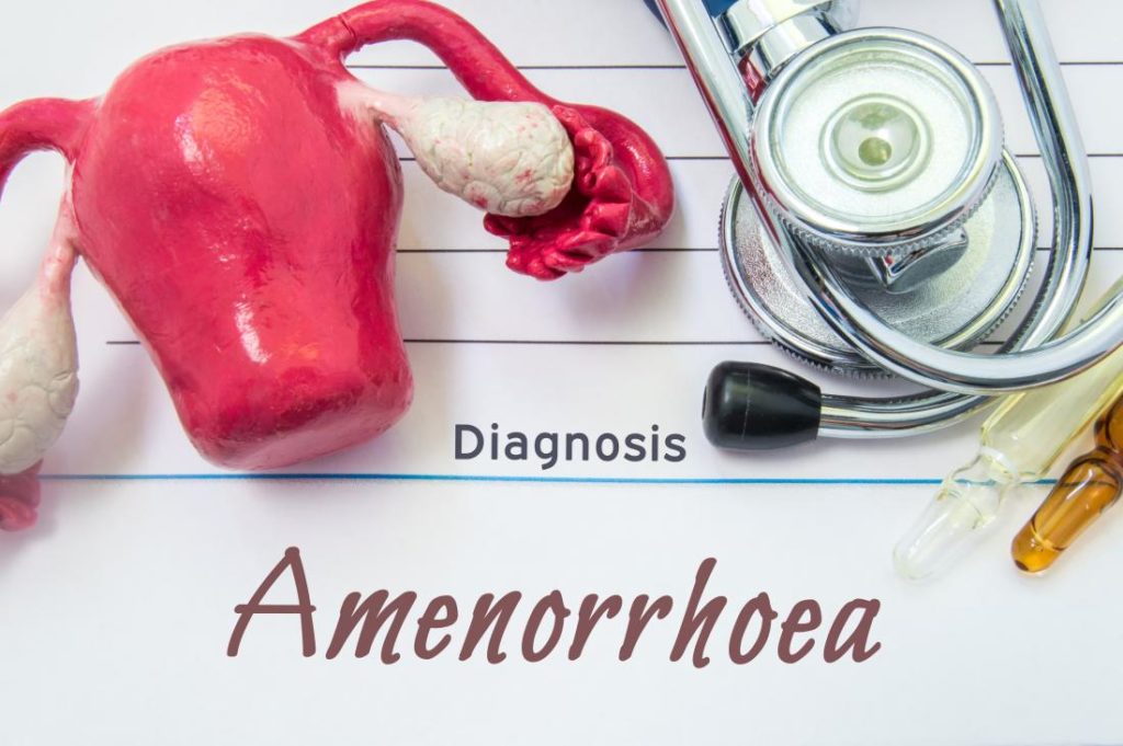 Amenorrhea  Diagnosis and Treatment