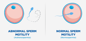 sperm motility