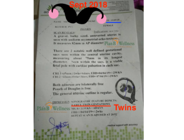 Surprise TWIN Pregnancy Testimony (Scan Inside)