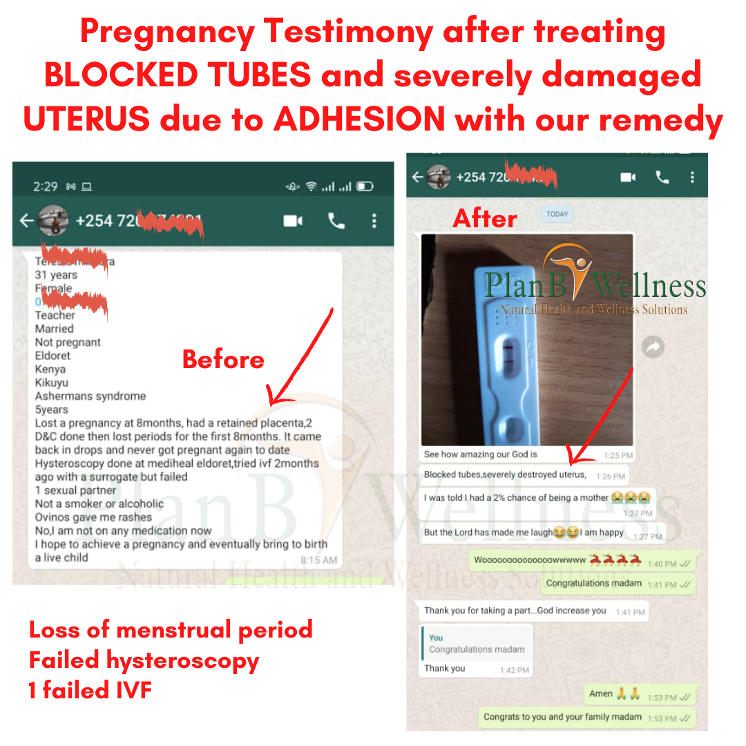 Plan B Wellness - Pregnancy Testimony after treating BLOCKED TUBES and severely damaged UTERUS due to ADHESION with our remedy