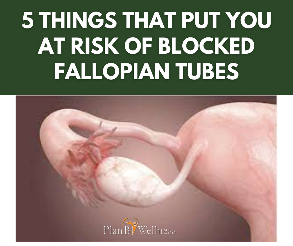 5 THINGS THAT PUT YOU AT RISK OF BLOCKED FALLOPIAN TUBES