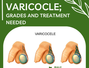 Varicocele: Grades and Treatment Needed