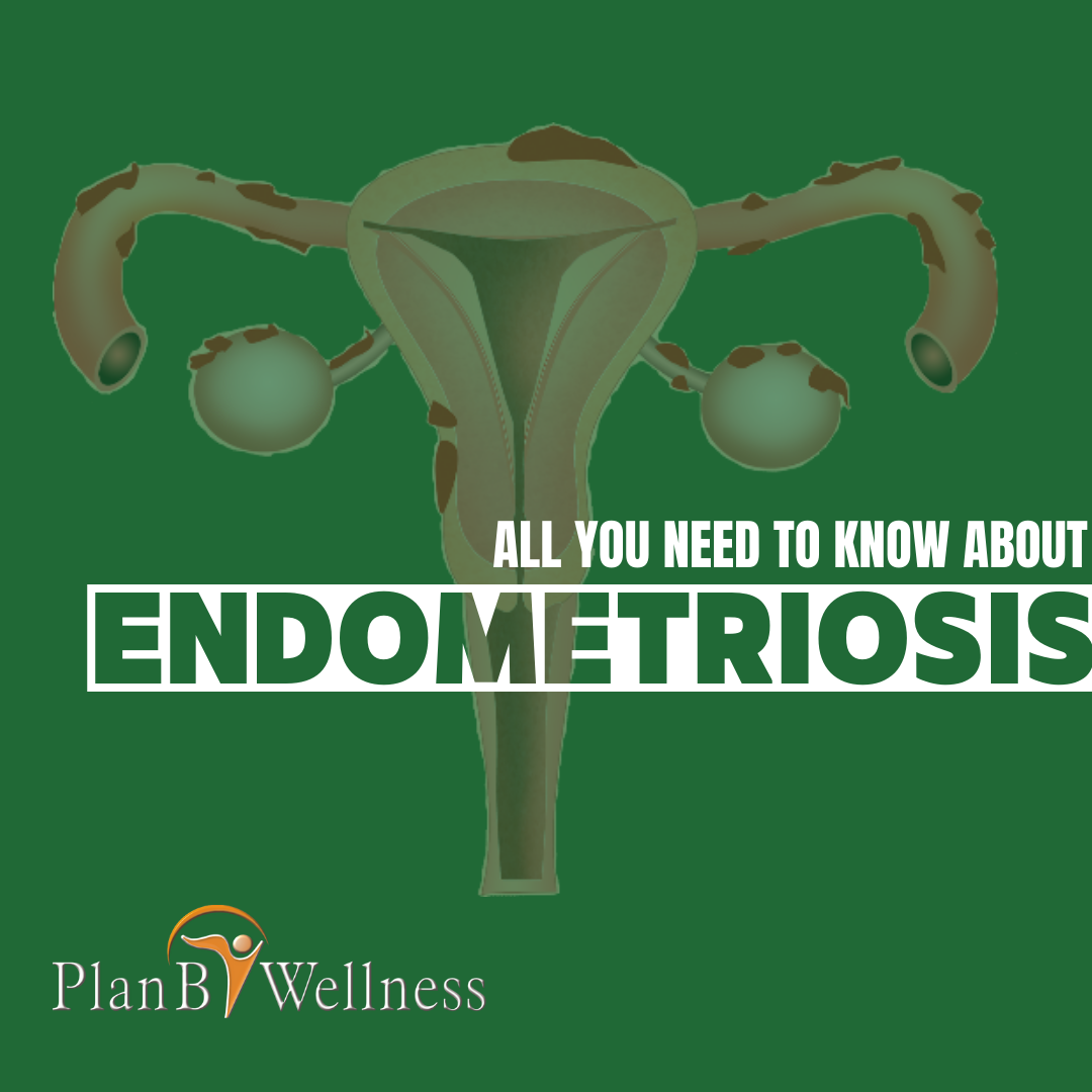 All You Need to Know About Endometriosis